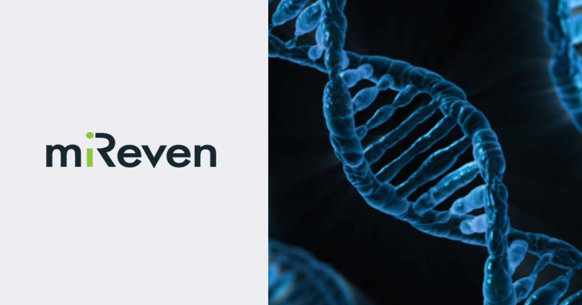 MiReven logo